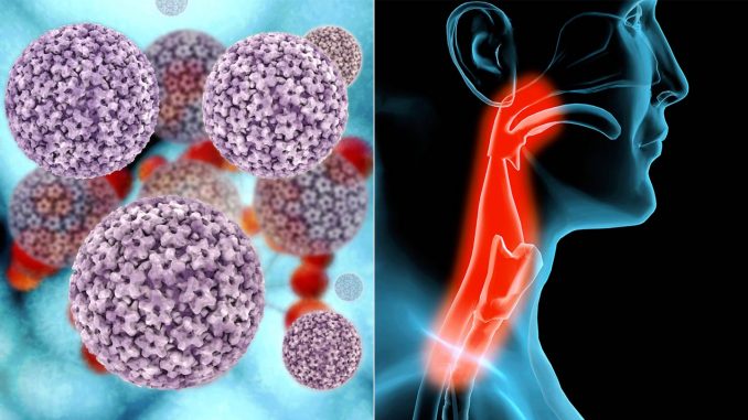 سرطان الحلق أسبابه وأعراضه ومخاطرة وطرق الوقاية منه ثقف نفسك 1271