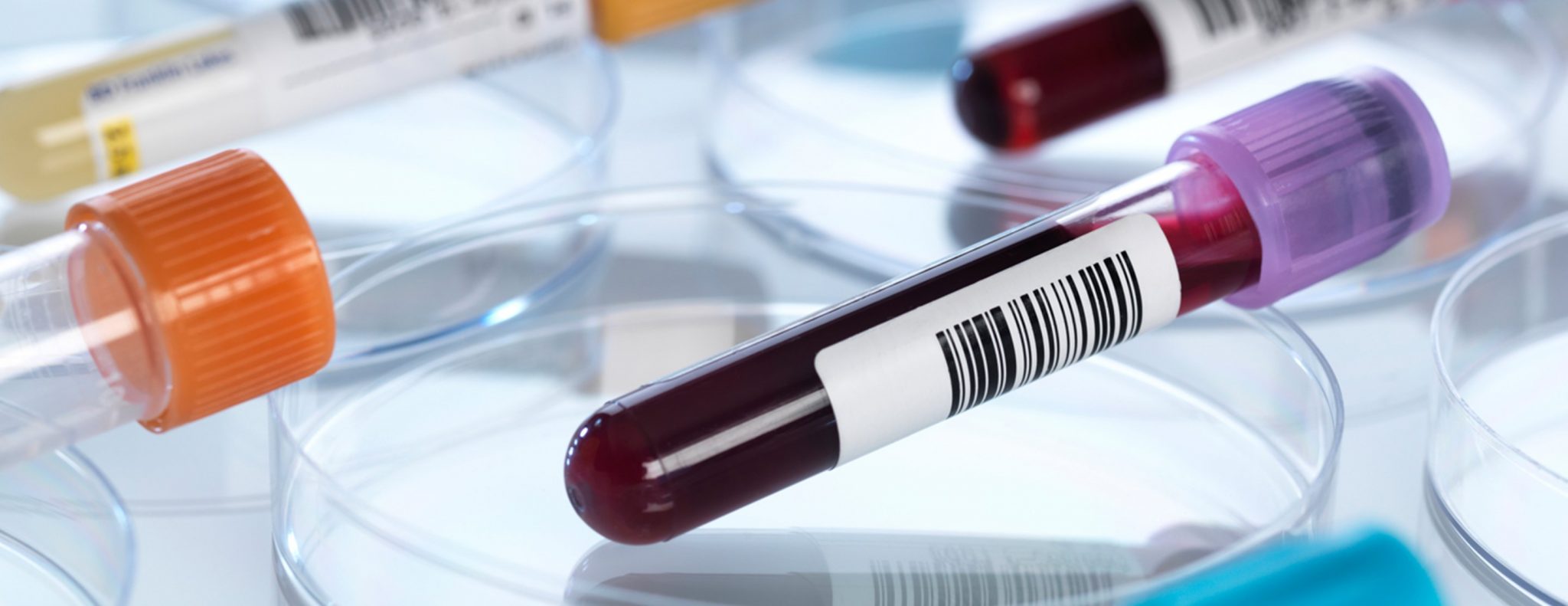 high-potassium-levels-in-a-blood-test-meridian-diagnostics