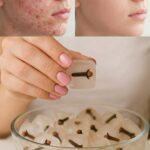 فوائد مكعبات ثلج القرنفل لعلاج الشيخوخة وحب الشباب