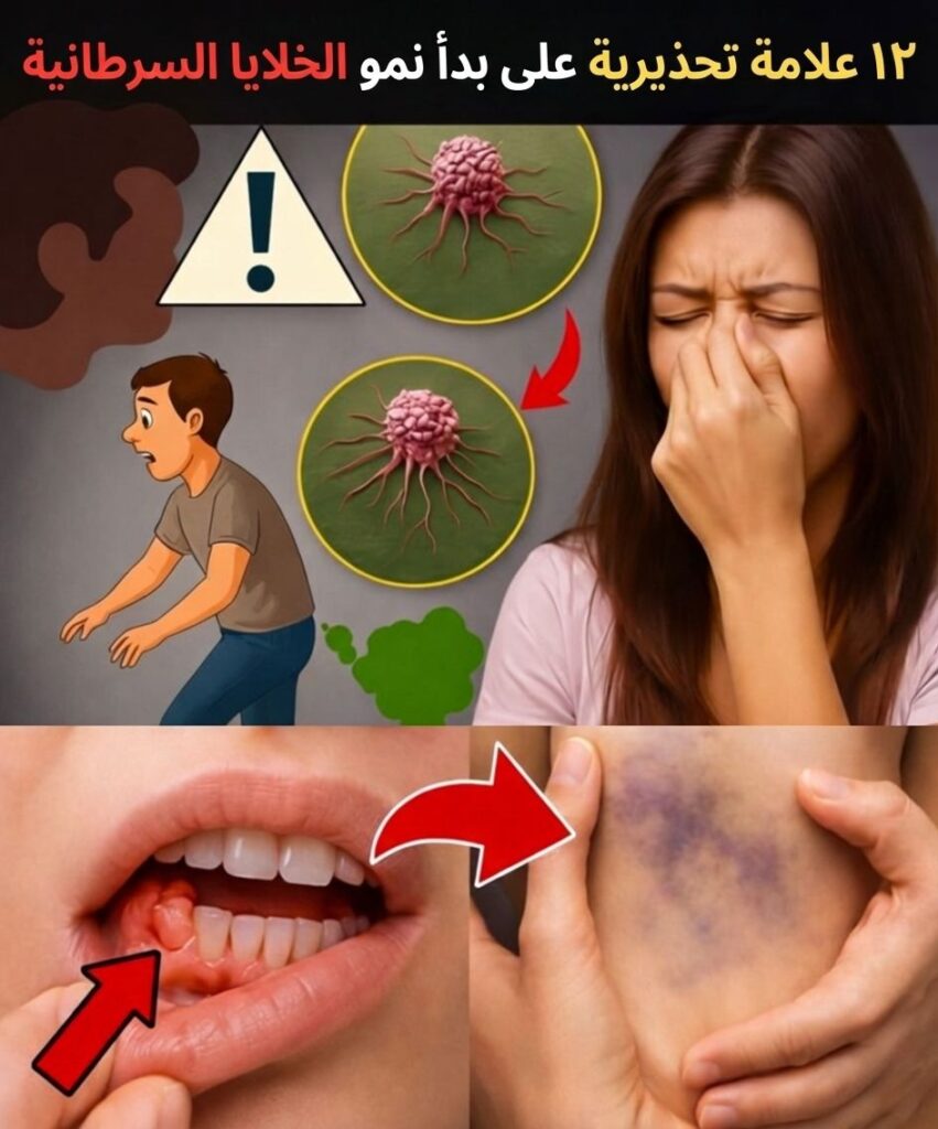 نمو خلايا سرطانية في الجسم..