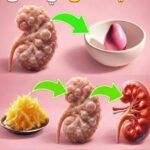 إذابة حصوات الكلى و تخفيف حموضة البول