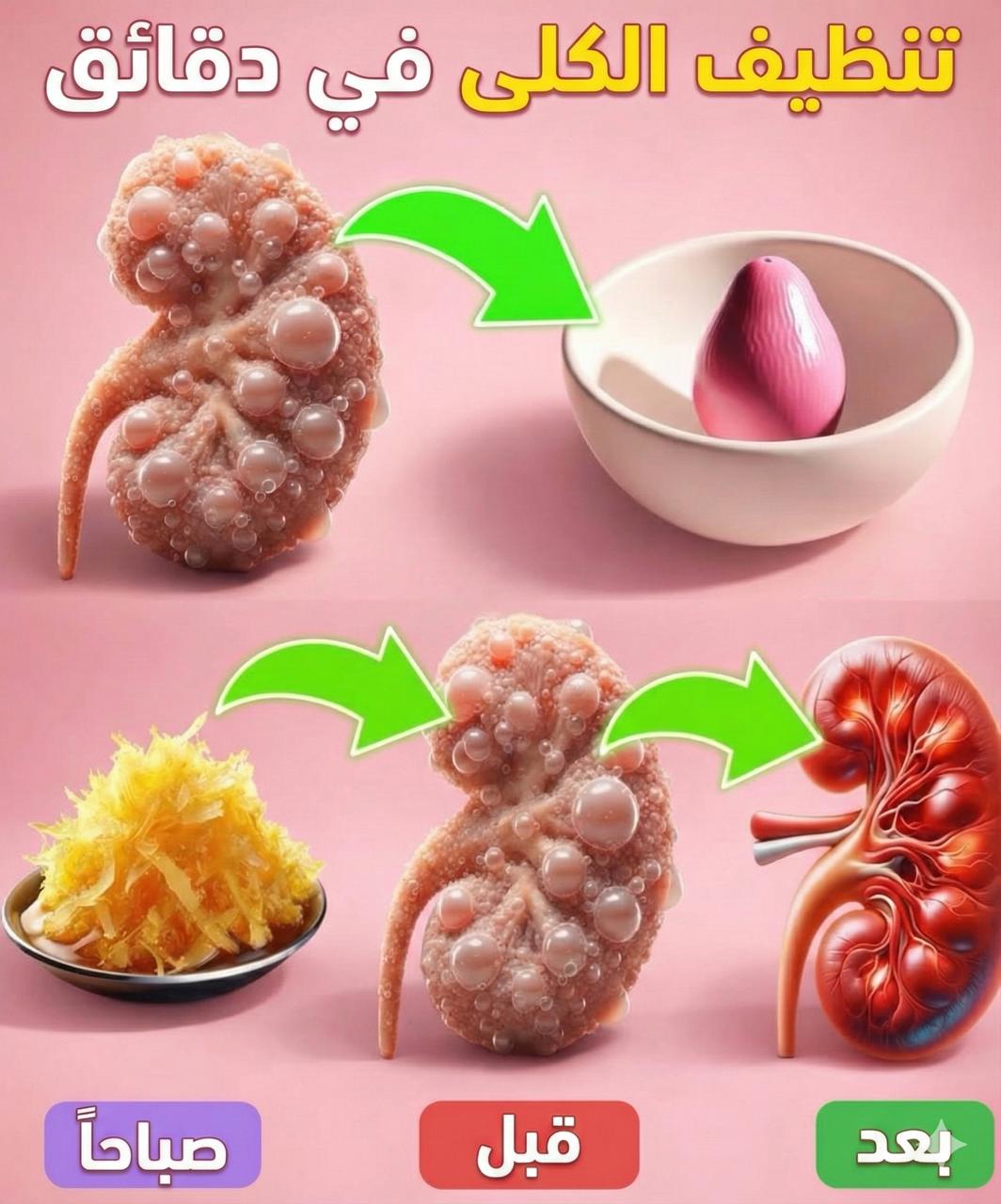 إذابة حصوات الكلى و تخفيف حموضة البول