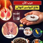 دليلك الشامل للتخلص من آلام البواسير