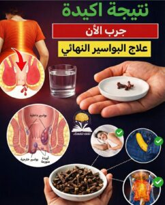 دليلك الشامل للتخلص من آلام البواسير