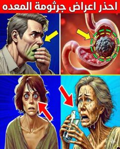 أعراض جرثومة المعدة: دليلك الشامل للتشخيص، العدوى، والعلاج