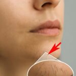 شعر الذقن عند النساء وداعاً للإحراج