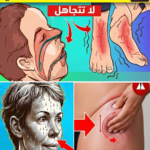 علامات مرض السكر