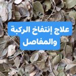 انتفاخ الركبة والمفاصل