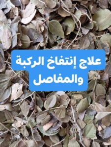 انتفاخ الركبة والمفاصل