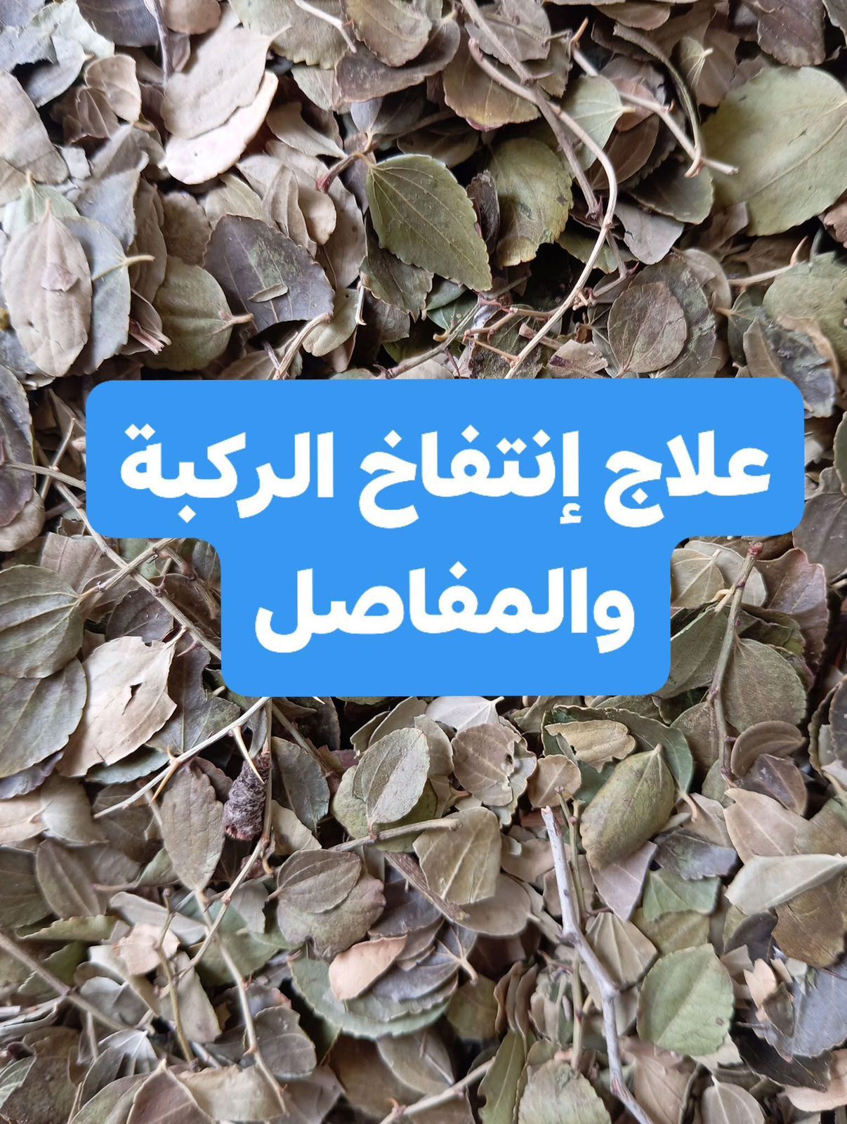 انتفاخ الركبة والمفاصل