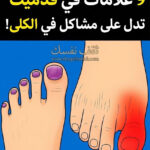 9 علامات لمشاكل في الكلى تظهر بالقدم