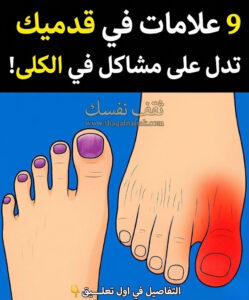 9 علامات لمشاكل في الكلى تظهر بالقدم