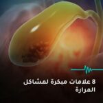 مشكلة في المرارة