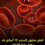 اعراض نقص مخزون الحديد