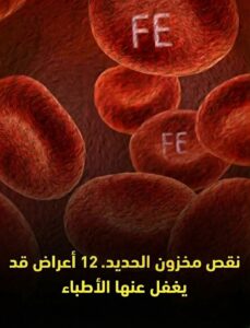 اعراض نقص مخزون الحديد