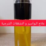 البواسير والتشققات الشرجية