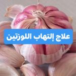 علاج التهاب اللوزتين بالثوم