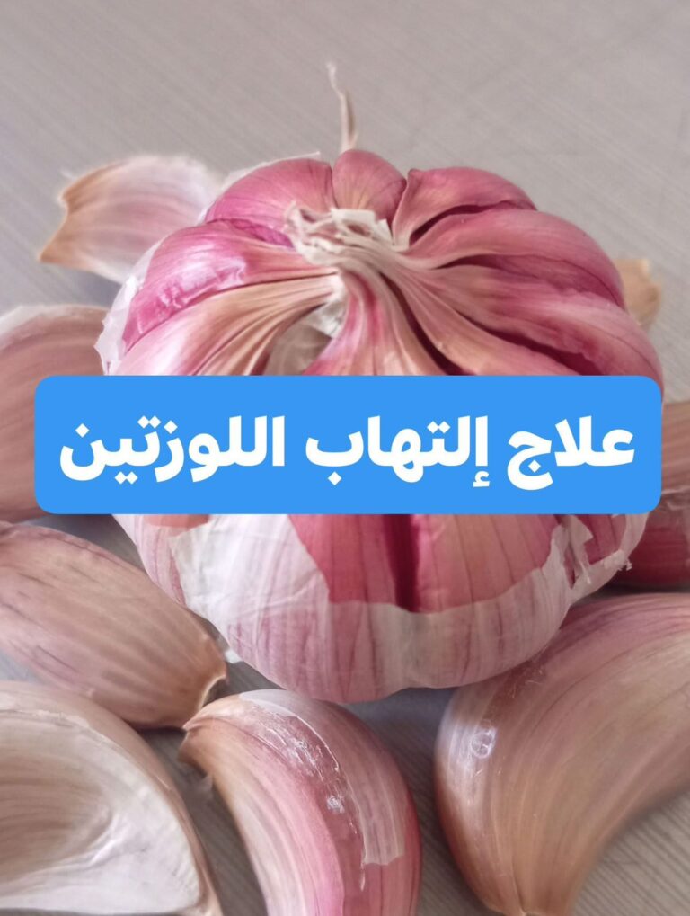 علاج التهاب اللوزتين بالثوم