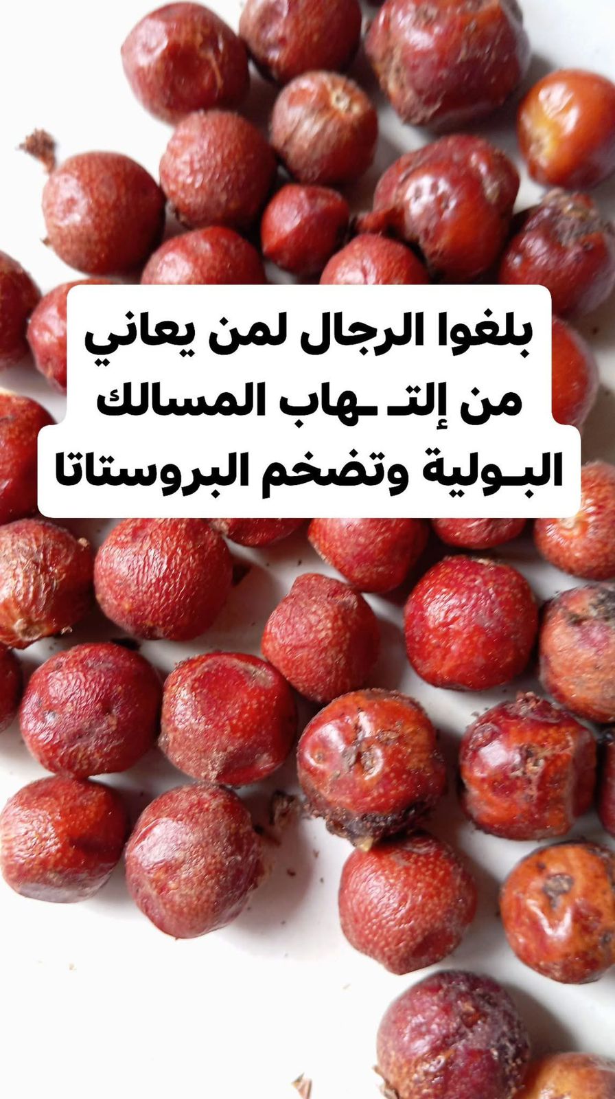 مشاكل المسالك البولية وتضخم البروستاتا