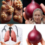 وصفة البصل لتنظيف الشعب الهوائية وعلاج السعال في ثلاثة أيام!