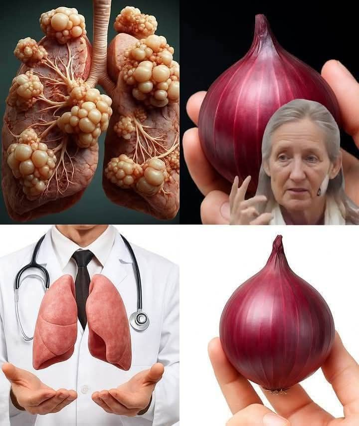 وصفة البصل لتنظيف الشعب الهوائية وعلاج السعال في ثلاثة أيام!