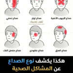 نوع الصداع الذي تشتكي منه