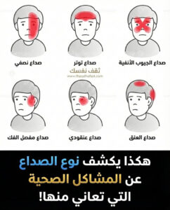 نوع الصداع الذي تشتكي منه