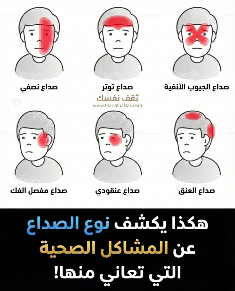 نوع الصداع الذي تشتكي منه