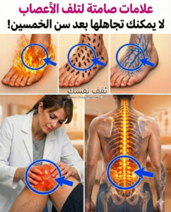 تلف الأعصاب