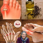 زيت يقضى على حمض اليوريك