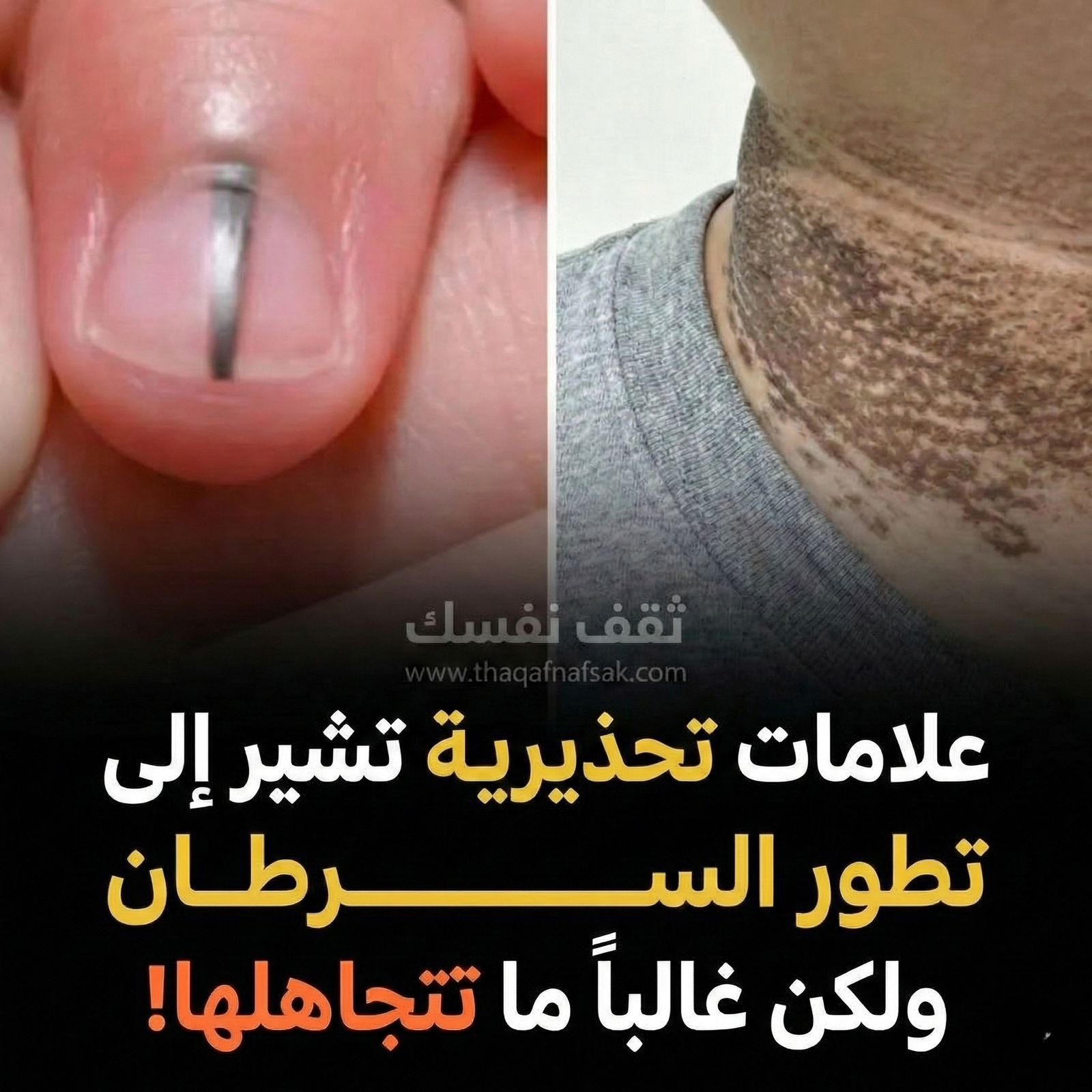 علامات السرطان المبكرة