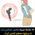 علامات نقص فيتامين د