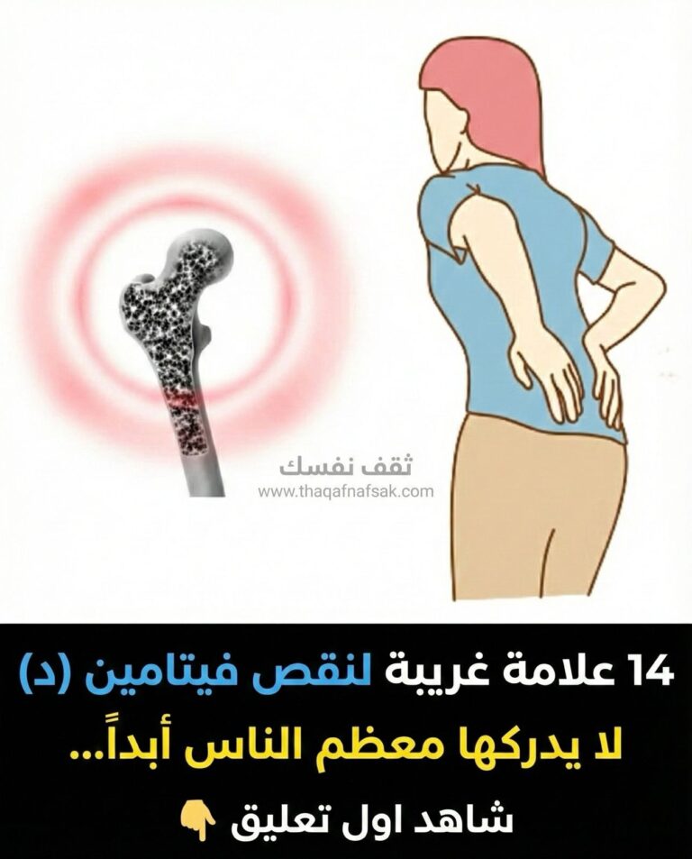 علامات نقص فيتامين د