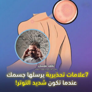 علامات التوتر