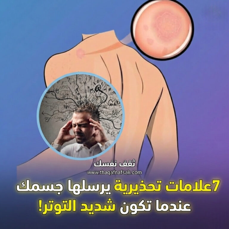 علامات التوتر