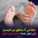 الحكة في 9 مناطق من الجسم