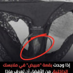 ماذا يعني وجود بقع بيضاء على الملابس الداخلية ؟