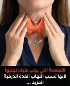 اطعمة تُسبب التهاب الغدة الدرقية
