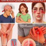 ارتفاع مستويات الكرياتينين