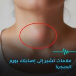 علامات الاصابة بورم الحنجرة