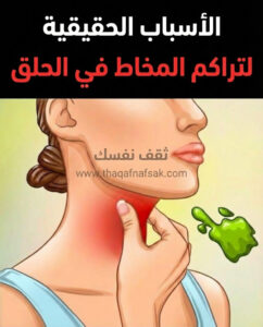 تراكم المخاط في الحلق