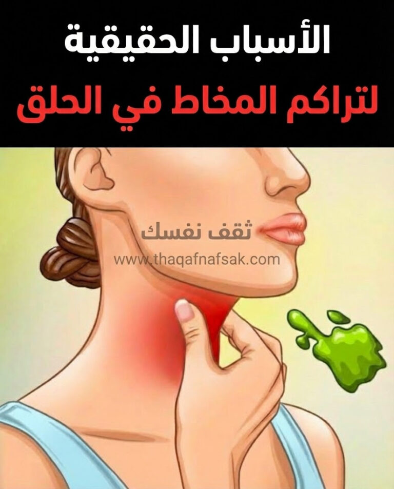 تراكم المخاط في الحلق