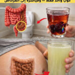 وداعاً للإمساك المزعج