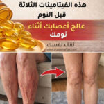 فيتامينات لتقوية الساقين