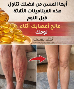 فيتامينات لتقوية الساقين