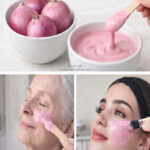 البصل الاحمر للبشرة