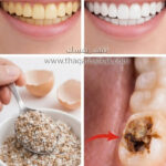 قشر البيض لإزالة الجير