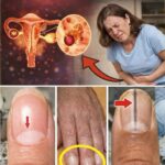 علامات تؤكد وجود مشاكل في المبايض