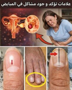 علامات تؤكد وجود مشاكل في المبايض