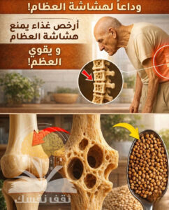 أطعمة لمحاربة هشاشة العظام